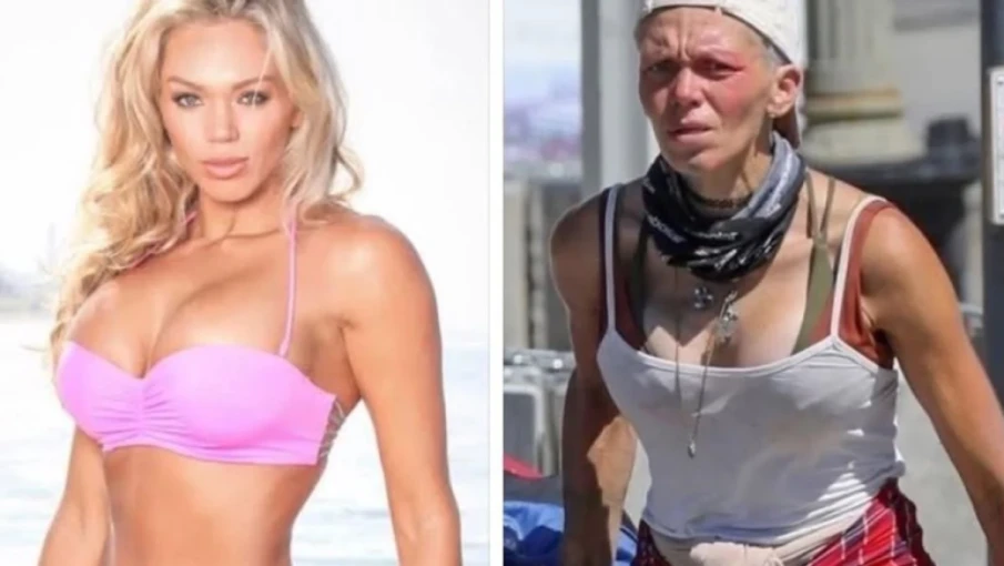 Şöhretten sokaklara: Eski modelin dramatik hayatı gündem oldu